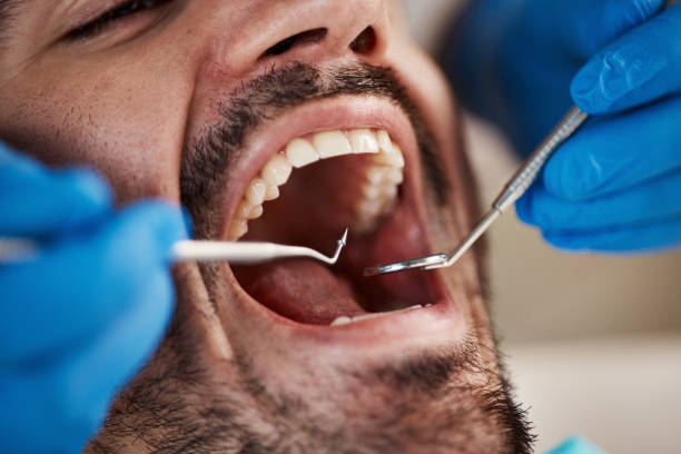Best Emergency Dental Services for Seniors in Pine Hills, CA